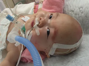 664gで生まれ､NICU に600日間入院した息子は2歳に｡「モニターじゃなくて赤ちゃんの表情を見て」という看護師の言葉に励まされながら・・・【体験談】