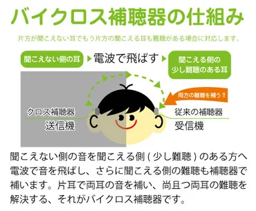 片耳難聴に合う補聴器の選び方【オススメを紹介】 